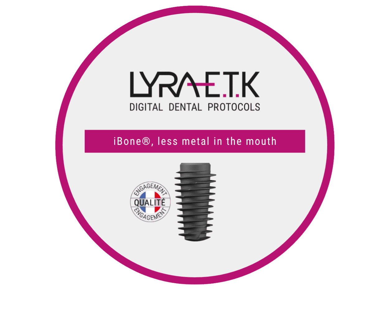 Implant dentar duke përdorur protokollin dixhital LYRA ETK për përmbajtje minimale metali në gojë.