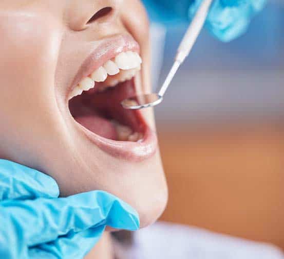 dental check up in tirana